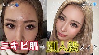 ニキビ肌から別人級になったメイクがやばい。。。本気で隠せる